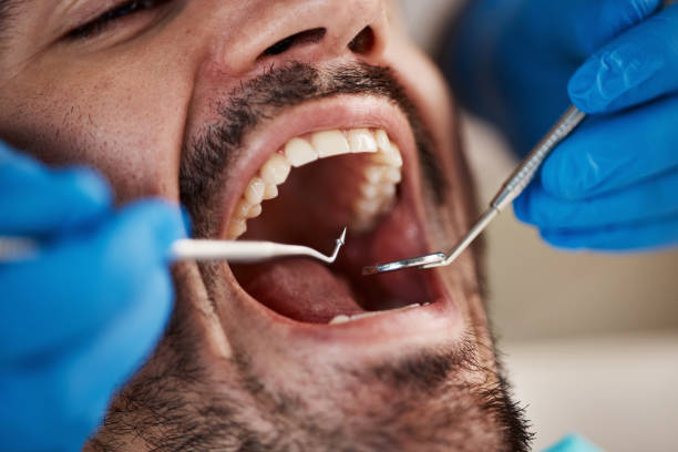 Best Emergency Dental Care for Broken or Chipped Teeth in Sun Lakes, AZ